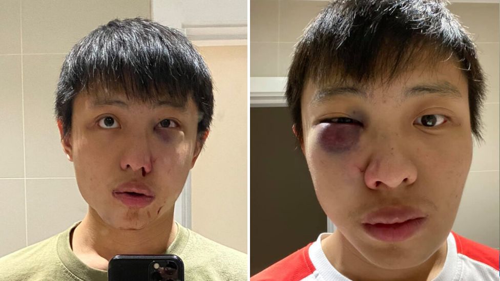 Asian Man Assaulted By White Teens Because of Coronavirus Racism